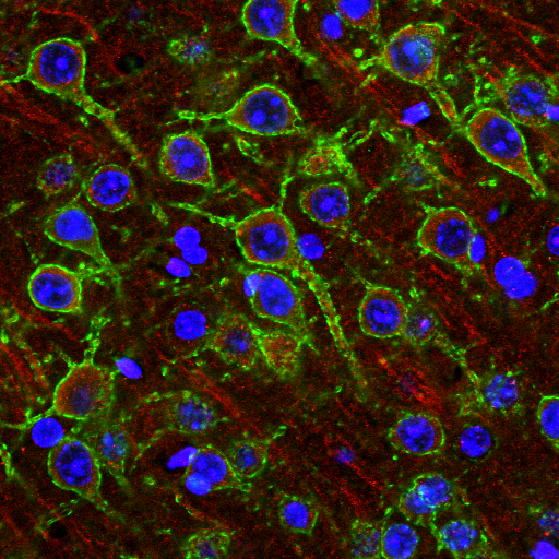 Neuronal staining in hippocal slice