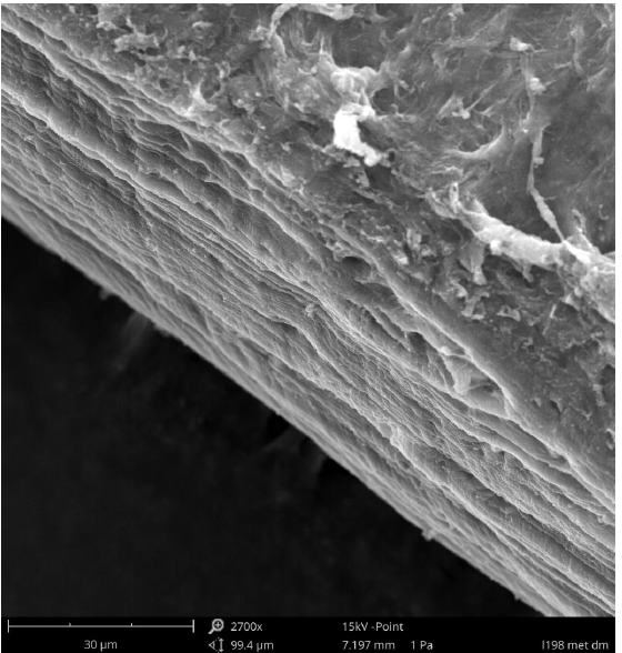 Diagonal cross section of a corneal tissue. Courtesy of Prof. Assunta Pandolfi