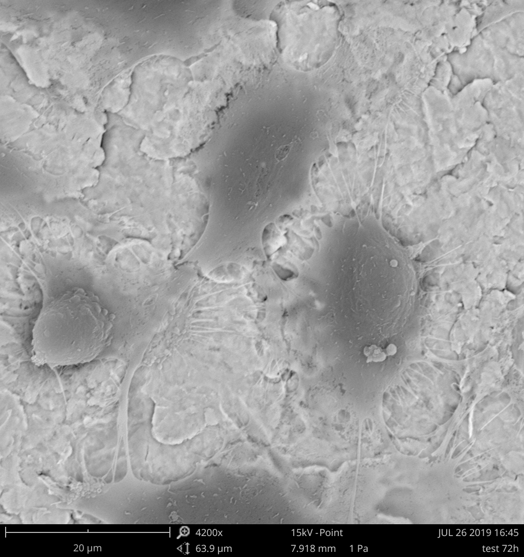 Endothelial cells growing on a Ti alloy substrate. Courtesy of Susi Zara